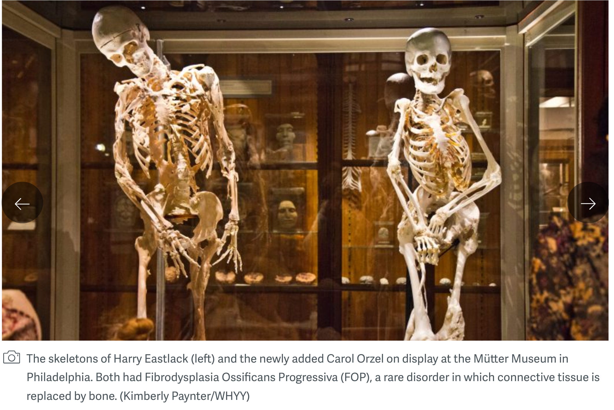 The Mütter Müseüm - by Thomas Pluck - Fox at Timber Creek