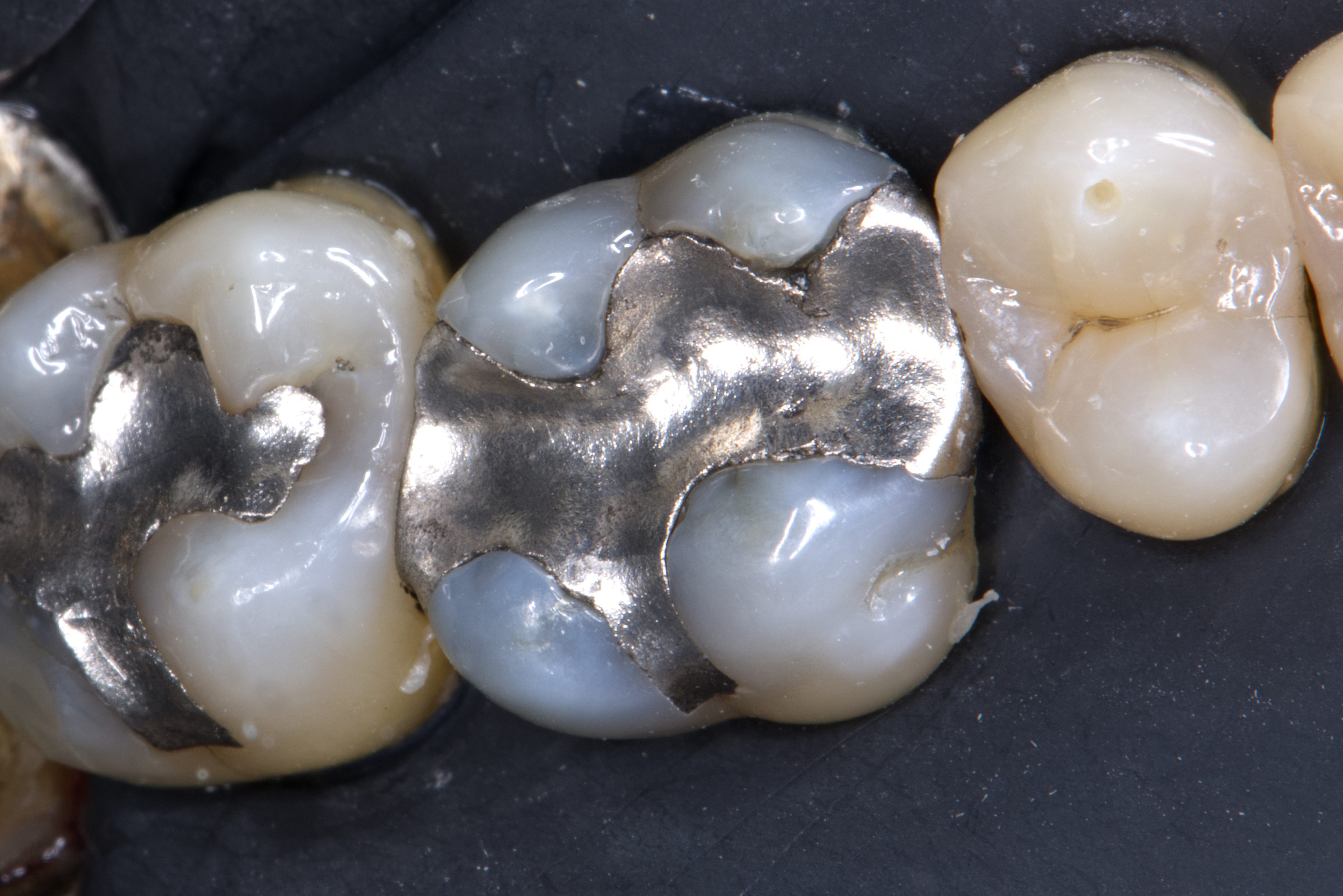 Oh Snap by Brandon Walker D D S