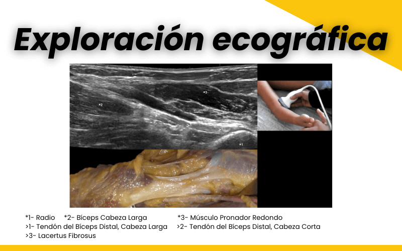 tend-n-distal-del-b-ceps-y-ecograf-a-by-tempo-formaci-n