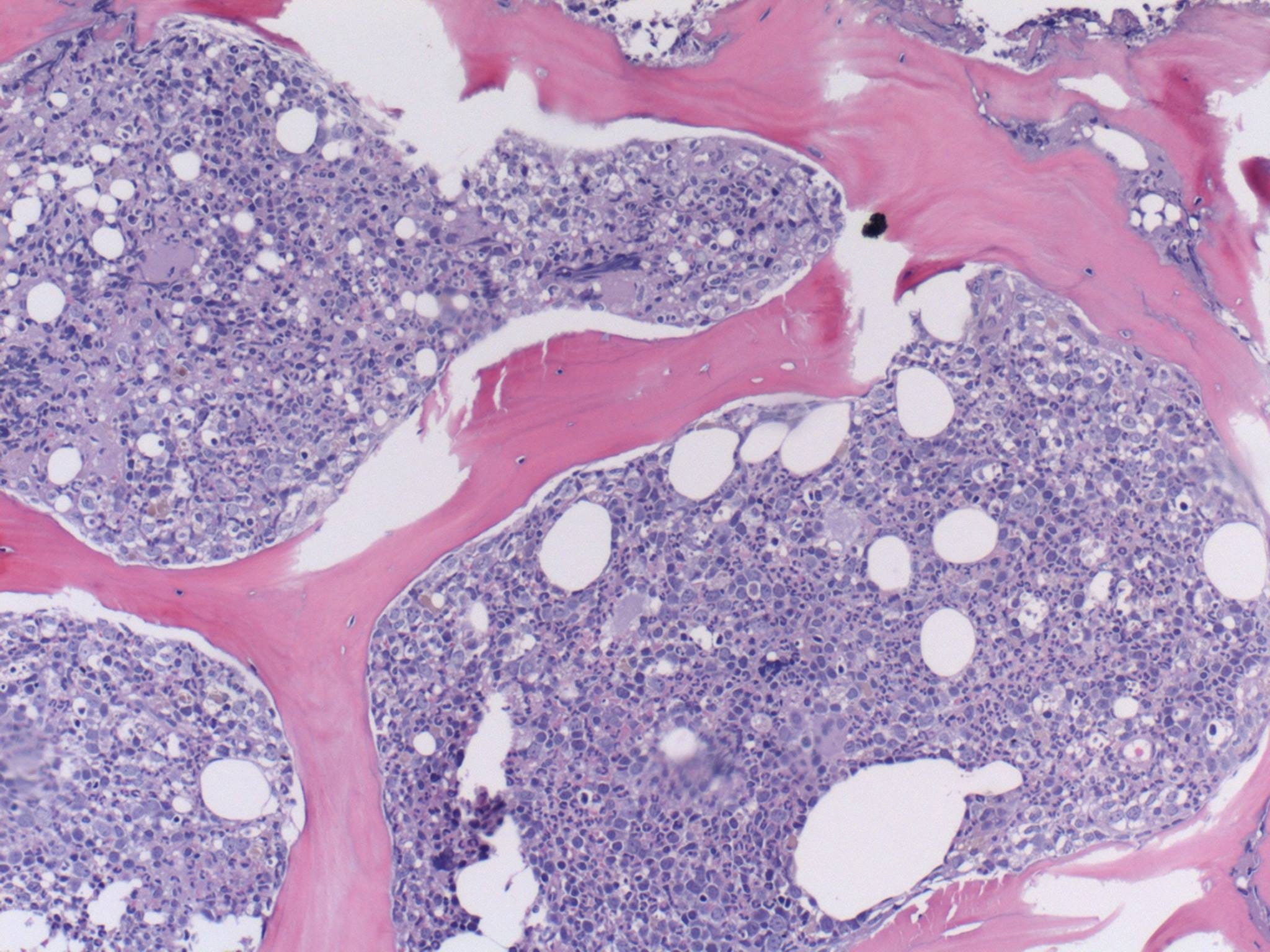 Demystifying Bone Marrow by Eric Fish, DVM, PhD