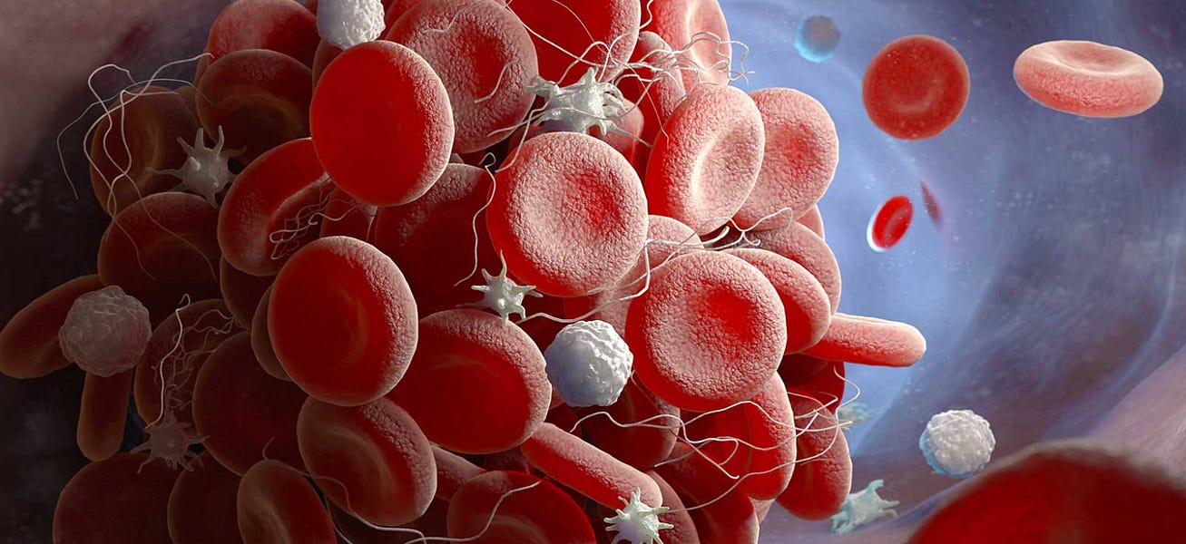 COVID VAX FLYING BLOOD CLOTS By Aristidis