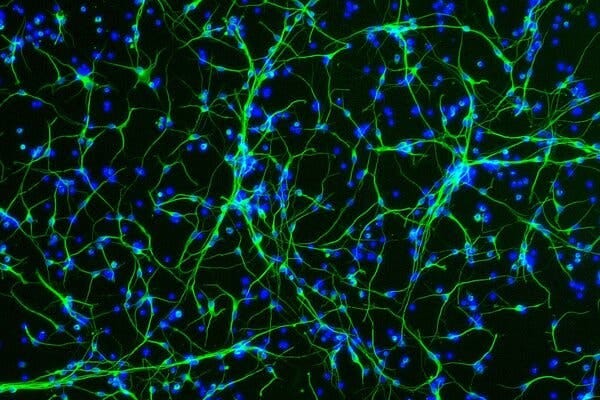 A microscopic view of neurons, colored bright green and blue.