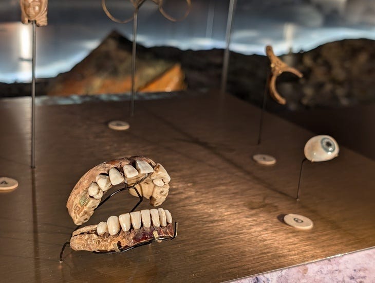 Exhibits from the Mudlarking exhibition include some false teeth and a glass eyeball