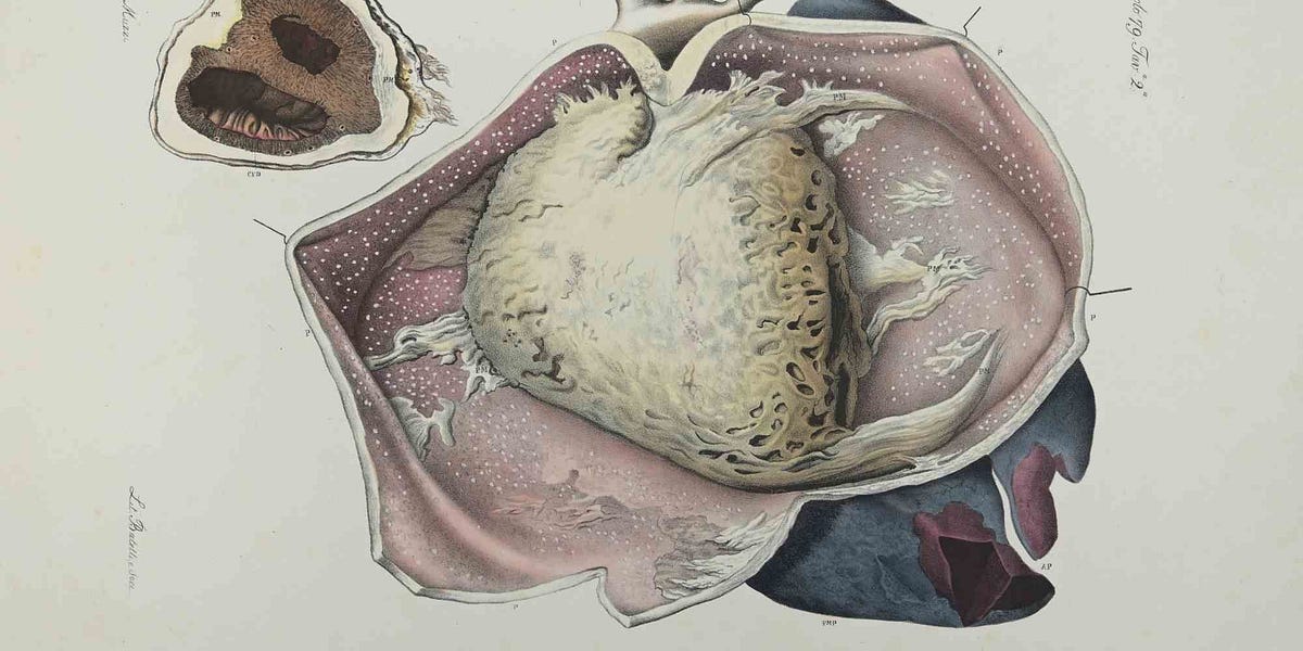 Thumbnail of A study of the heart