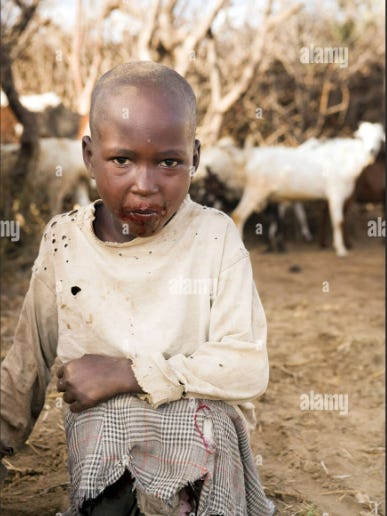 NextImg:USAID Does Not Help African babies