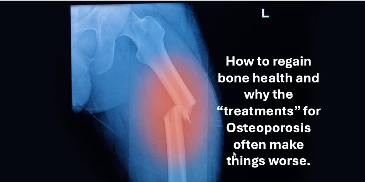 The Great Osteoporosis Scam