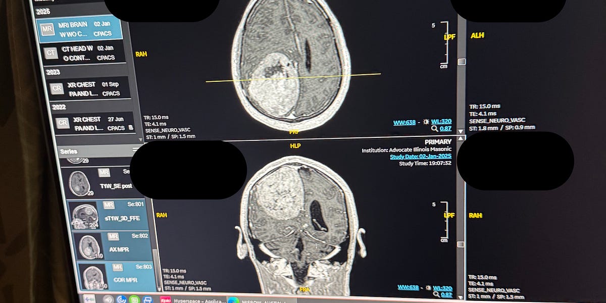 Story Jan 5, 2025 by Austin Mierow All in My Head
