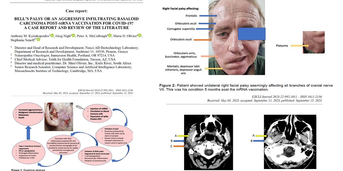 Published Report Concludes mRNA Injection is the Cause of Cancer