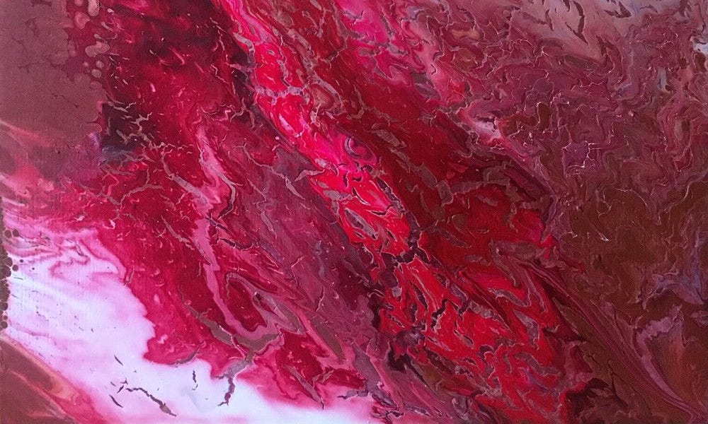 SARSCoV2 Impacts Kidneys and Vitamin D Metabolism