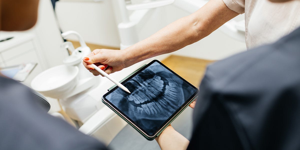 Do Almost 30% of Women Lose a Tooth