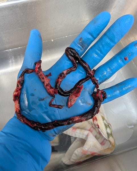 Correlation Is Not Causation, Except When It Is: Lessons from Thalidomide, Smoking, Asbestos, and mRNA Vaccine Concerns