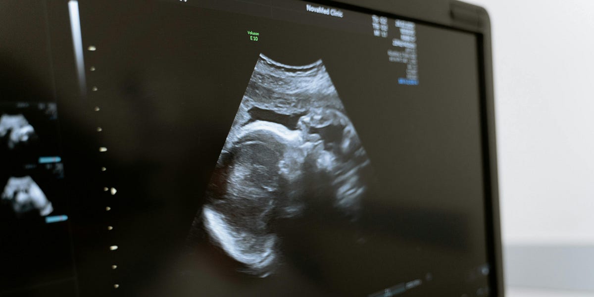 King County Doubles Down on Radical Abortion Agenda&mdash;At Taxpayer Expense