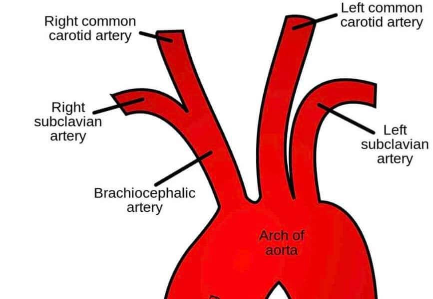 Is My Ascending Aorta Truly Enlarged or Enlarging?