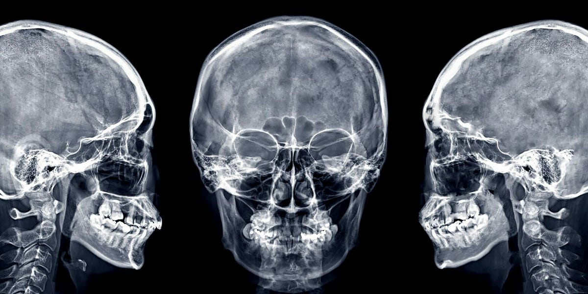 The Proper Headbutt Technique by Alias