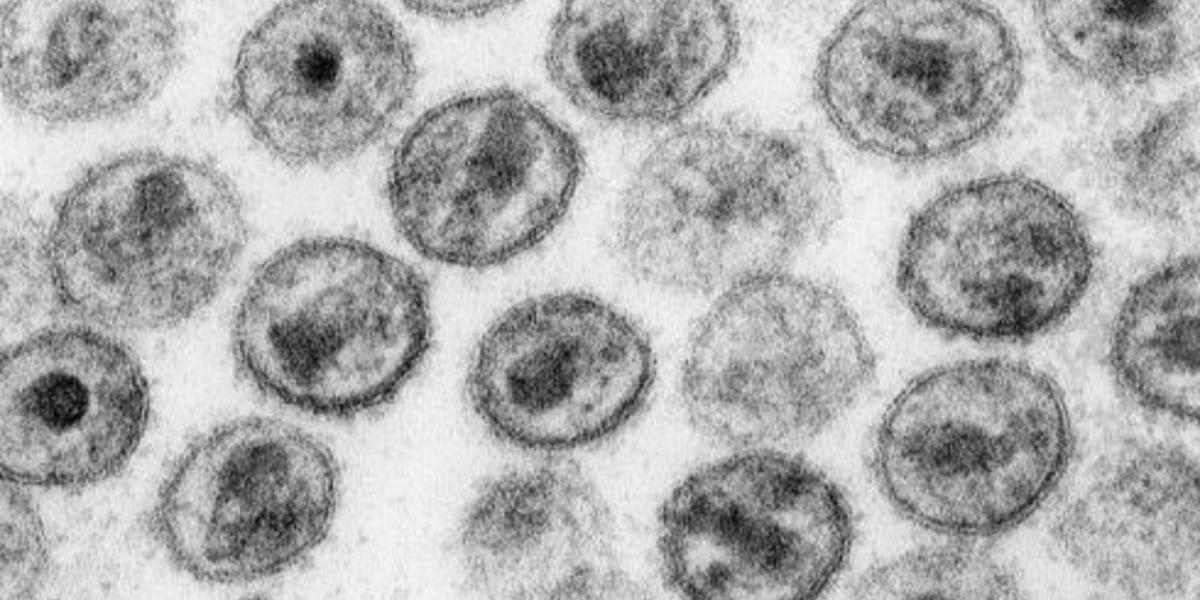 Hiv Trials Failed Because Of Igg4 Antibodies The history of failed HIV vaccine trials confirms that overvaccination