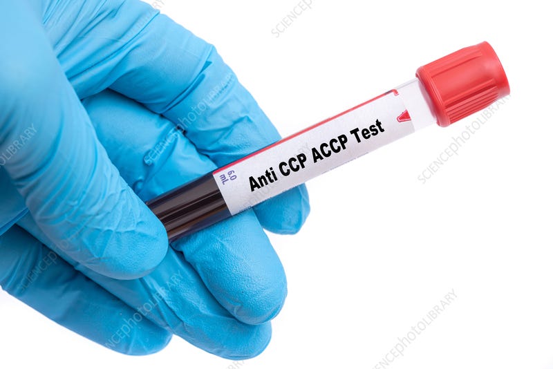 CCP Antibody Test MedInfoMatters