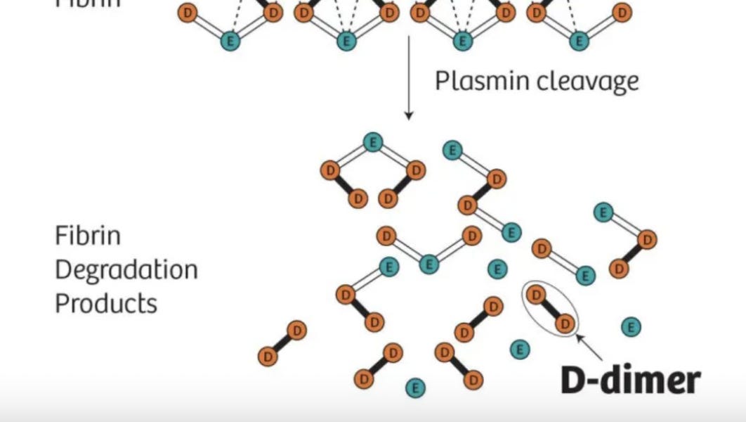 Ddimer and fibrinogen by Aaron Goodman "Papa Heme"