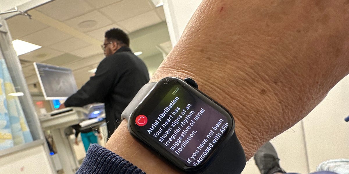 Watch that monitors 2025 afib