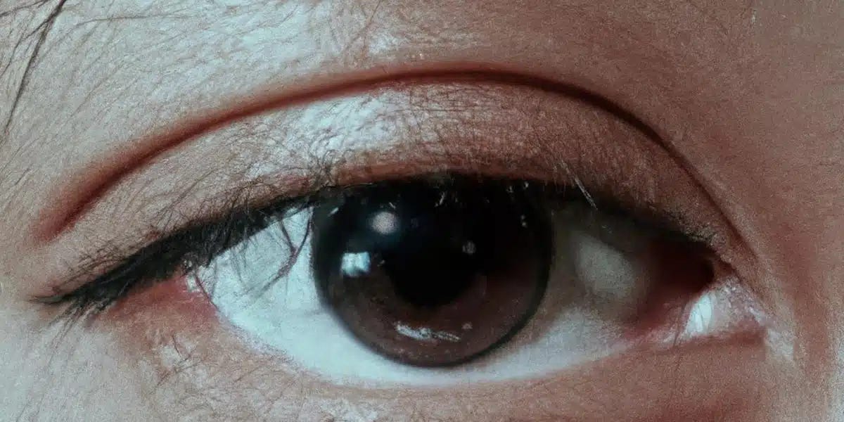 Gene Therapy for Dogs With Inherited Blinding Eye Disease Set for Human