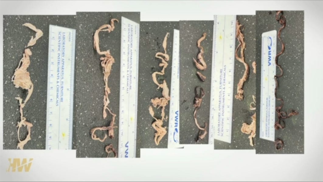 A recent reader completed survey has demonstrated that the mysterious blood clots do exist. Likewise...