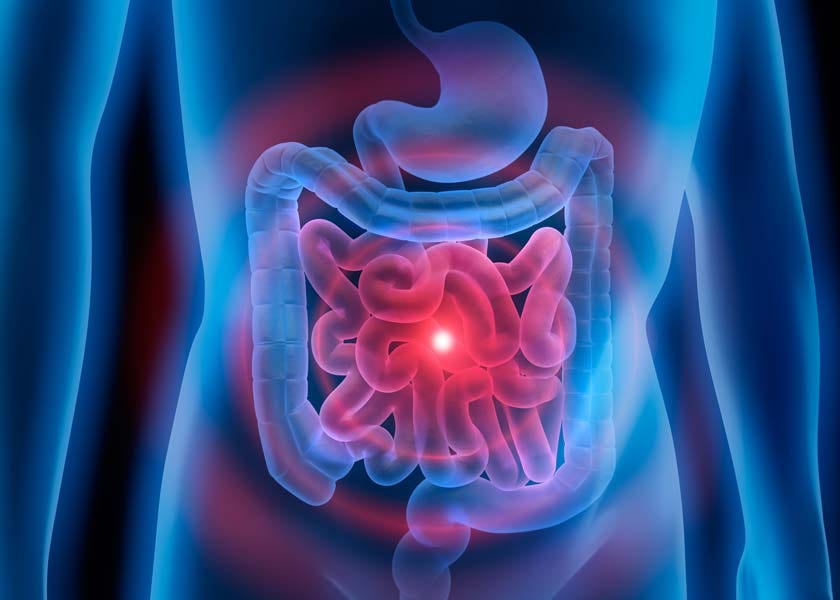 A Vibrating Pill for Constipation Goes to the FDA