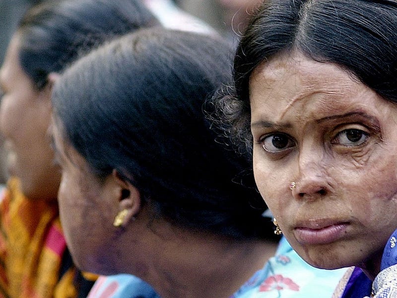 Acid Attacks Burning Issue in India Asia Sentinel