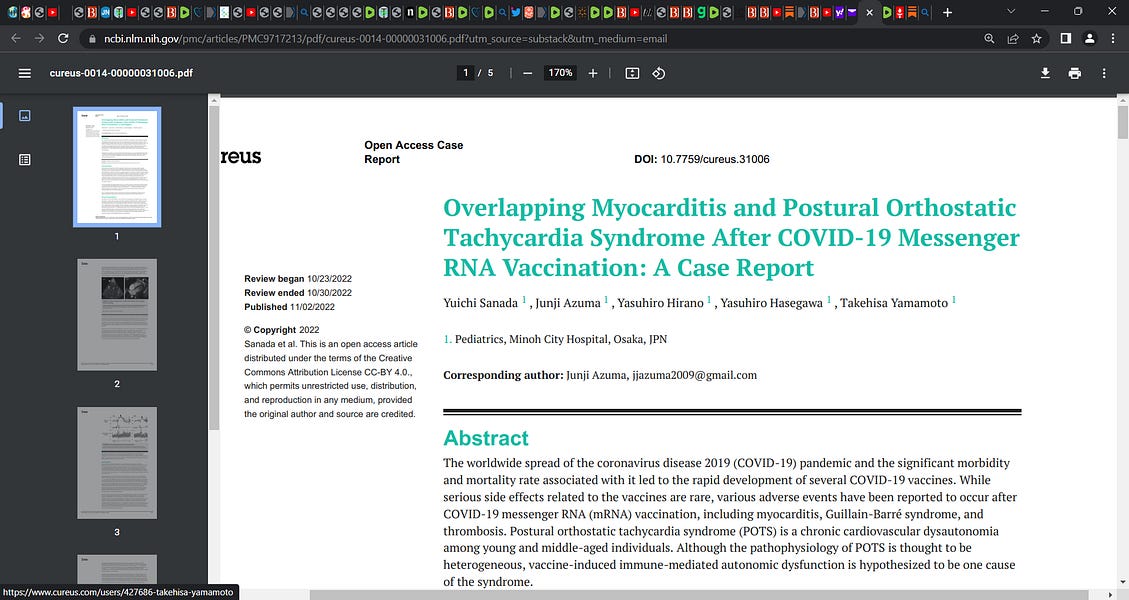 POTS (postural orthostatic cardiac tachycardia syndrome) after 2nd
