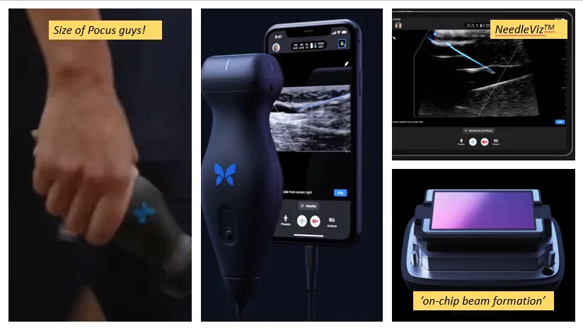 POCUS (Point Of Care UltraSound) in your Pocket