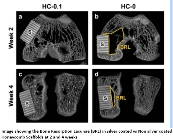 Silver Honeycomb Scaffolds - for Infection Control & Bone Healing