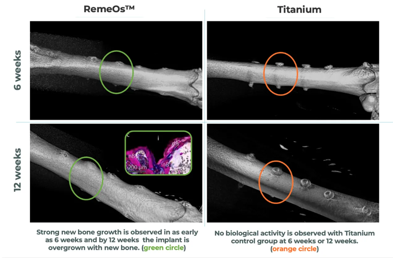 RemeOs Screw - for Trauma Fixation