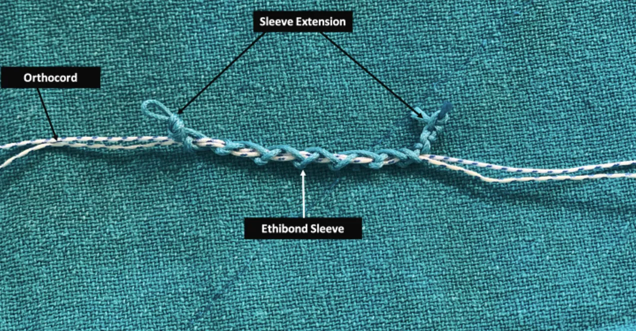 DIY All-Suture Anchor