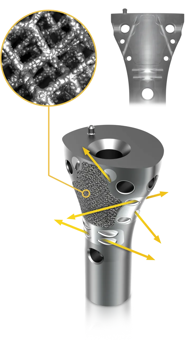 ELEOS - Proximal Tibial Limb Salvage System