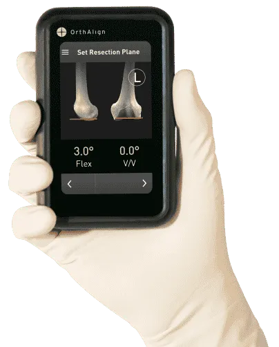 Lantern® - Device for Knee Arthroplasty