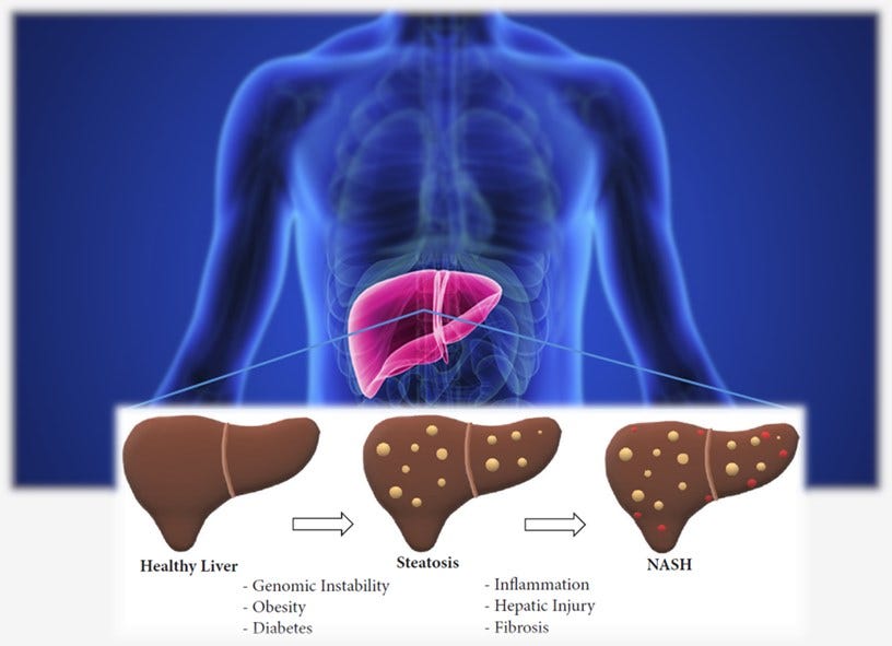 Liver Learnings: New News on NASH