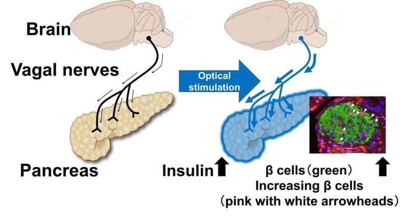 Metabolism Mashup: More musings on NASH and diabetes 