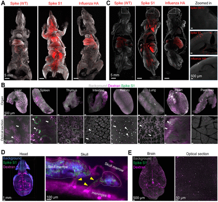 Mechanismen neuronaler Schäden durch die Covid modRNA-Produkte