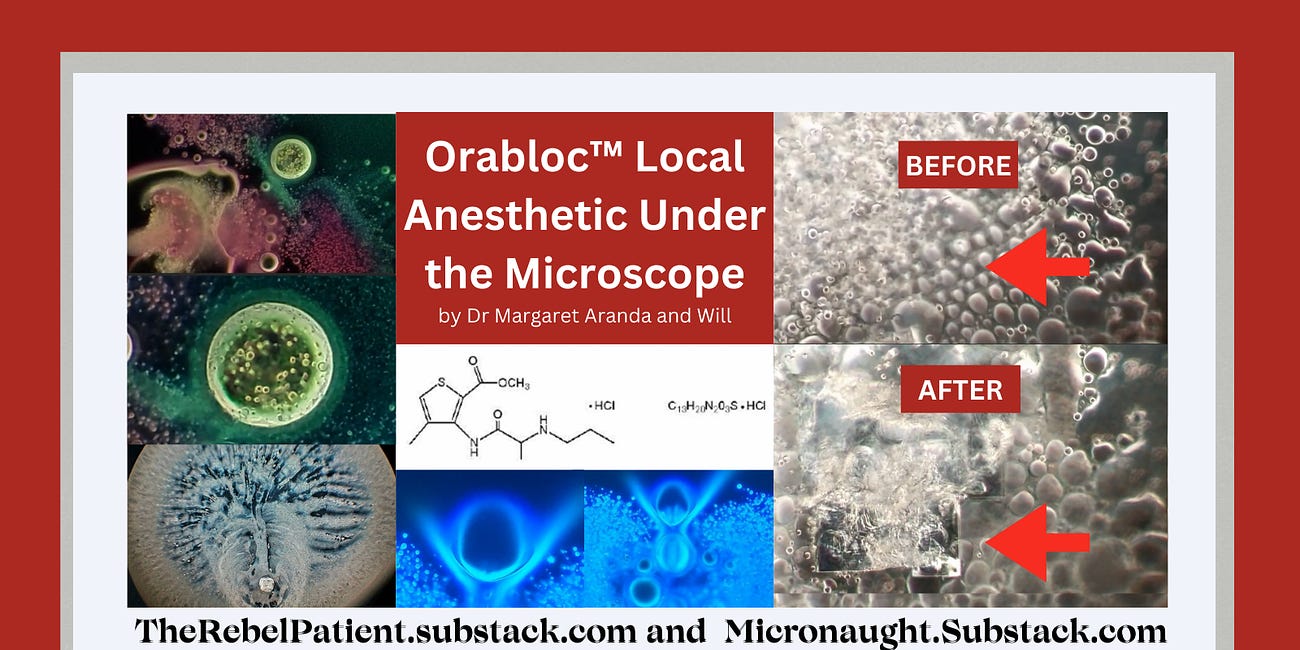 Orabloc™ (Articaine plus Epinephrine) Local Anesthetic Under the Microscope: Unidentified Objects Seen by Will at Micronaut.Substack.com