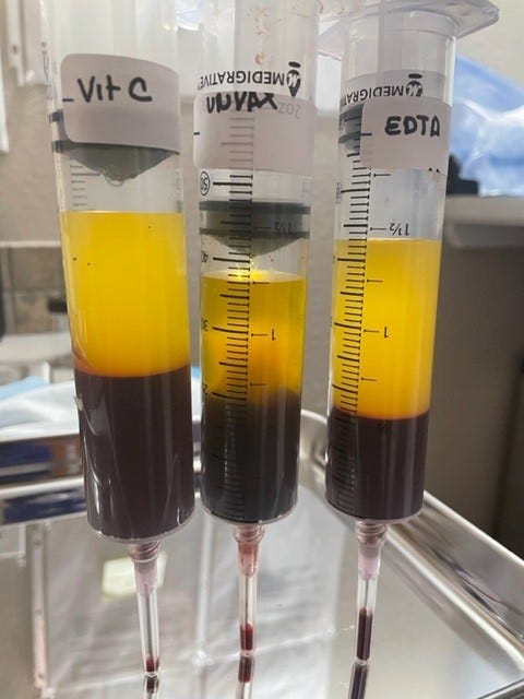 C19 Unvaccinated Have Same Blood Clotting Problem As C19 Vaccinated - EDTA And Vitamin C Prevents Blood Clotting In C19 Unvaccinated