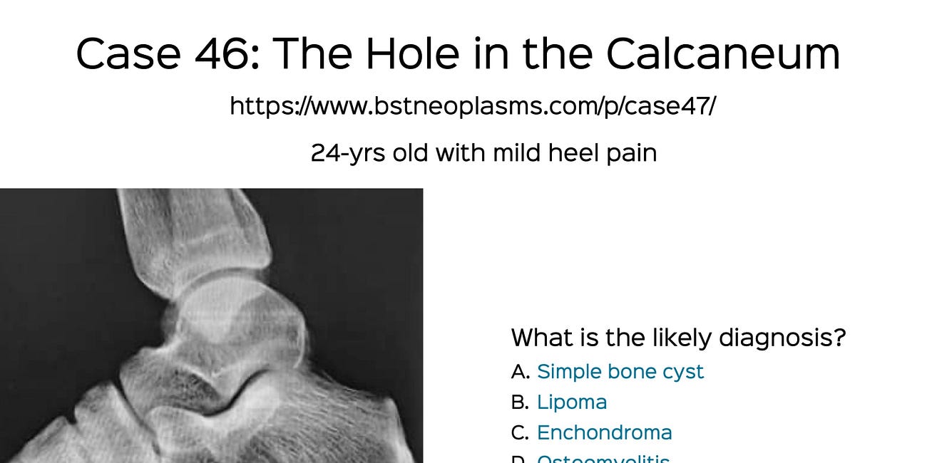 Case 47: The Hole in the Calcaneum