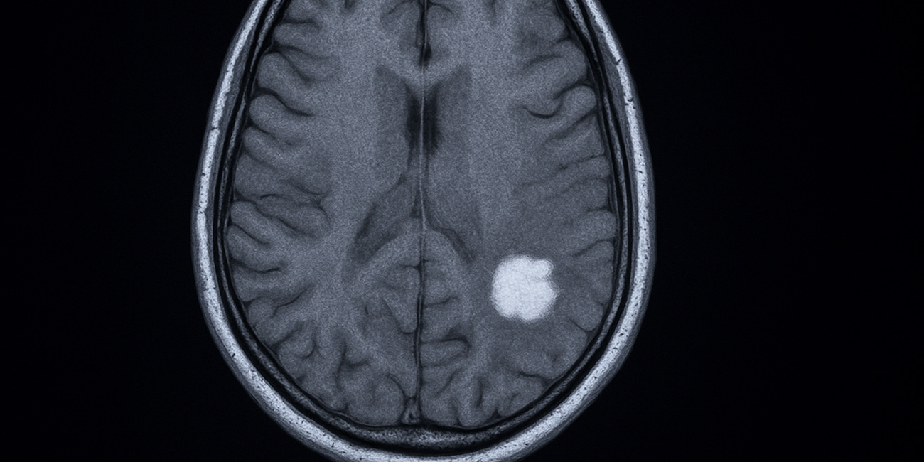 Help JP Riley fight brain cancer