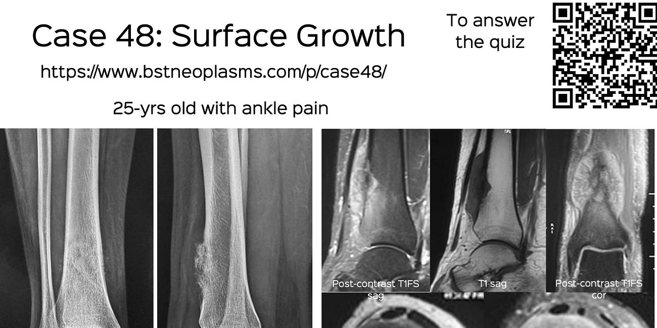 Case 48: Surface Growth