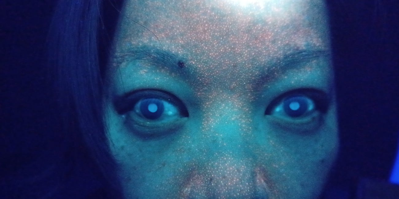 Fluorescent Orange Face Tattoo Under UV Light In C19 Vaccinated And Eye Of Horus Phenomenon - Are Humans Limbic Systems Being Altered For Behavior Modification? 