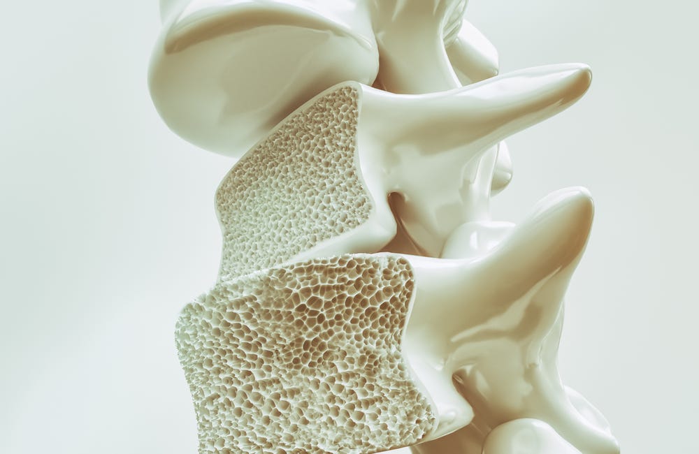 Osteoporosis and Bone Health 