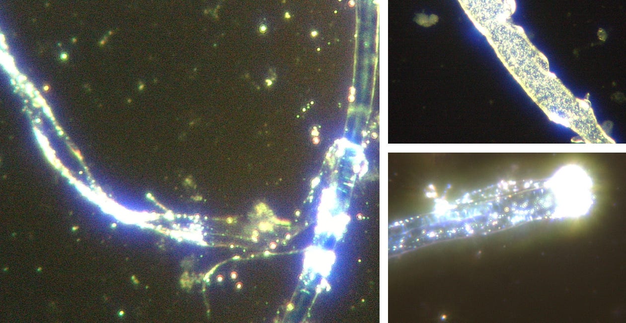Darkfield Microscopy of Canine Distemper - Adenovirus Parainfluenza-Parvovirus Vaccine - Routine Vaccination For Dogs Shows Microbots and Polymer Self Assembly