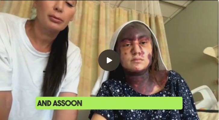 Vaccine Nightmare Survivor Alexis Lorenze is Going to Join Forces With the Vaccine-injured Community to Take Down the Criminal Medical System