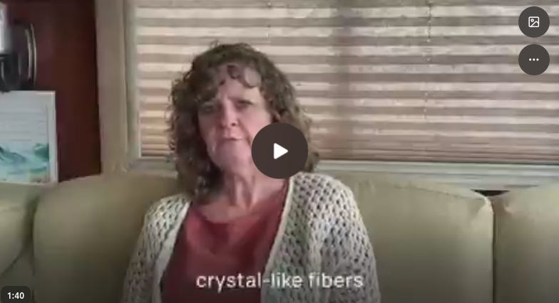 FRIGHTENING: "Crystal-Like Fibers" Coming Out of a Person's Fingers and Toes Following a Covid Injection