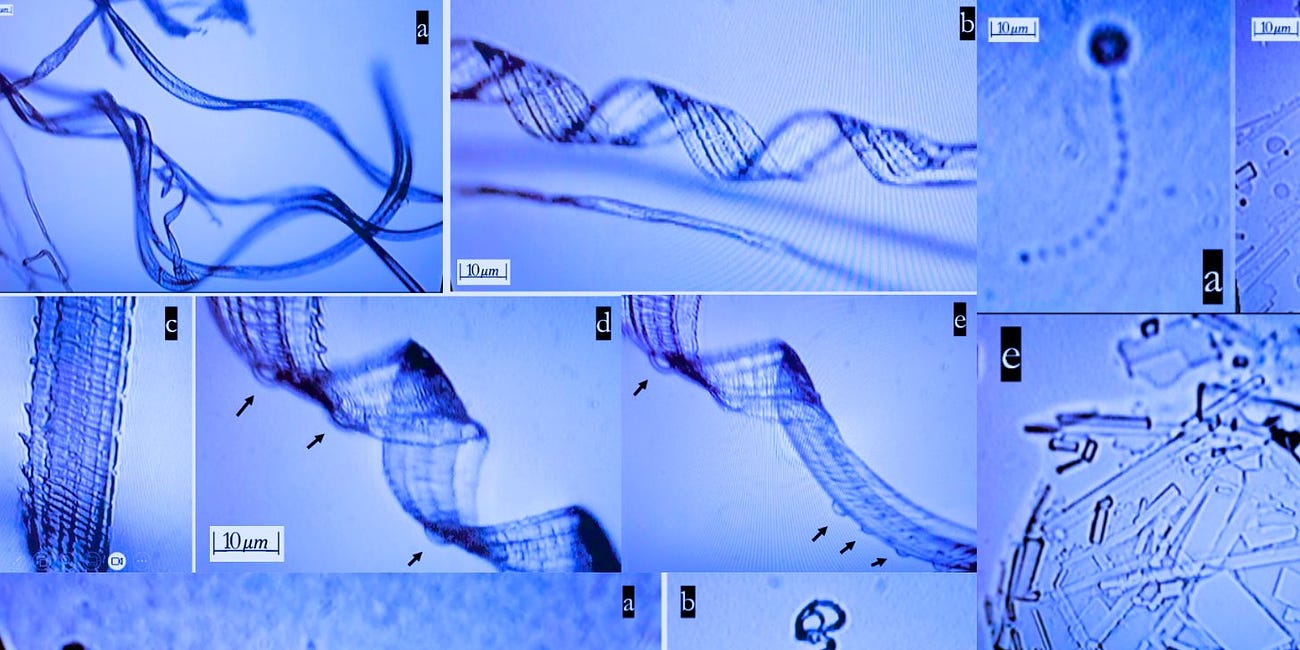 Millions of 'Self-Assembling' Nanotech Structures Found in COVID Shots: 'International Journal of Vaccine Theory, Practice, and Research'