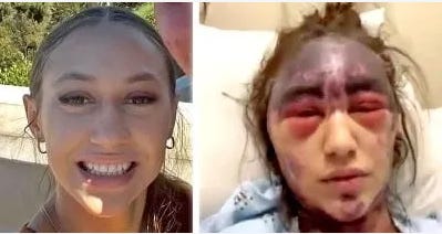 Michael Bryant: More to the Disturbing Story of Alexis Lorenze — A Medical Nightmare 