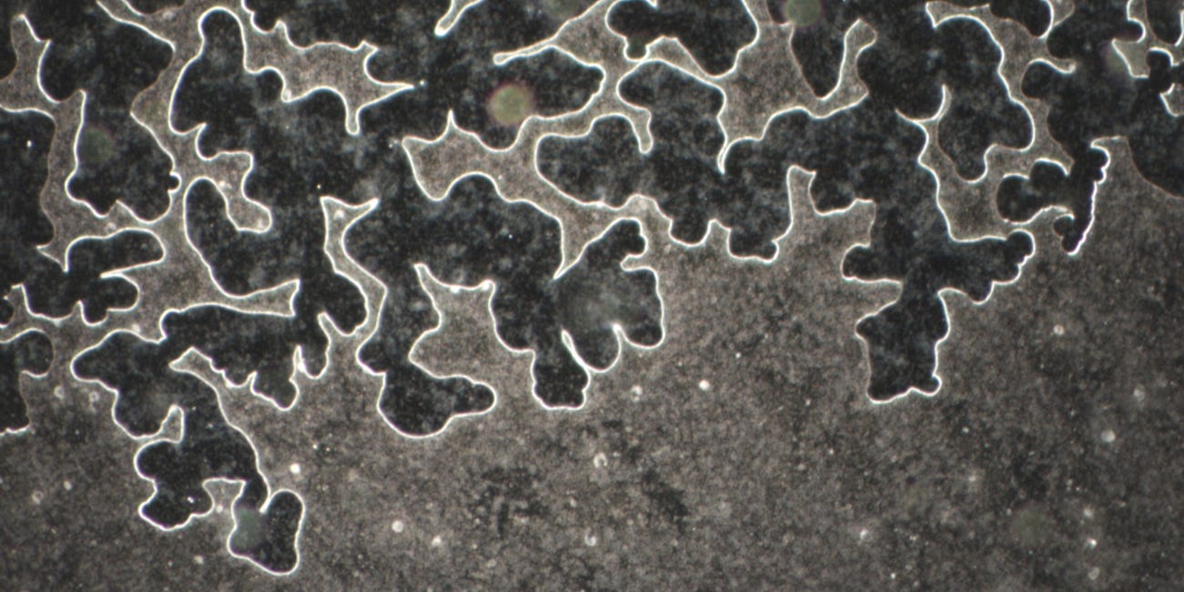 7-week-old blood - and complete cell structures are still visible