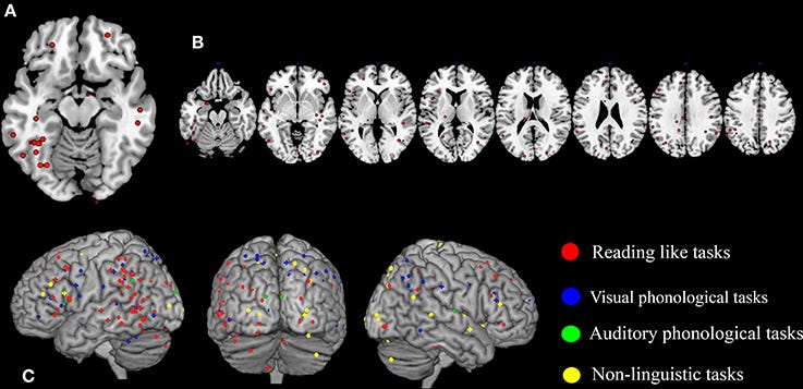 Shanahan: There are no brain-based methods of teaching reading!